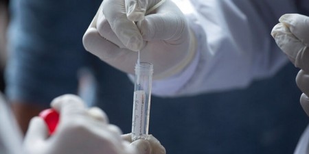 Η διάγνωση της νόσου Covid-19 με λήψη δείγματος από τον ίδιο τον ασθενή