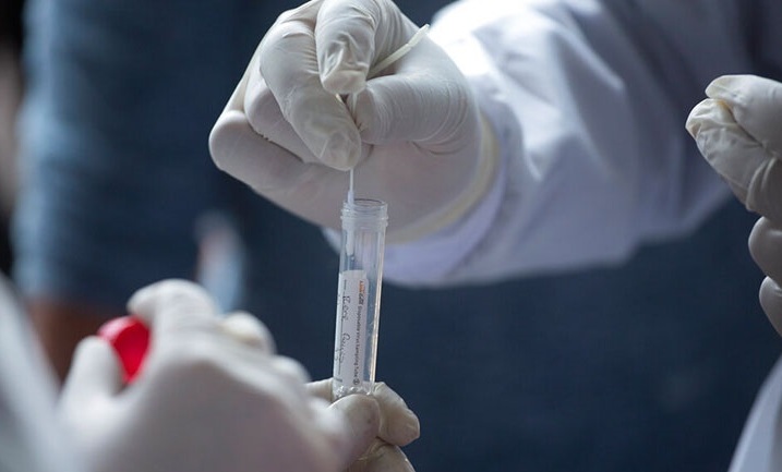 Η διάγνωση της νόσου Covid-19 με λήψη δείγματος από τον ίδιο τον ασθενή