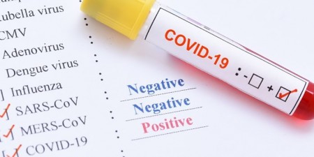 Προκλήσεις και προβλήματα από ψευδώς αρνητικά αποτελέσματα σε ασθενείς με λοίμωξη από τον ιό SARS-CoV-2