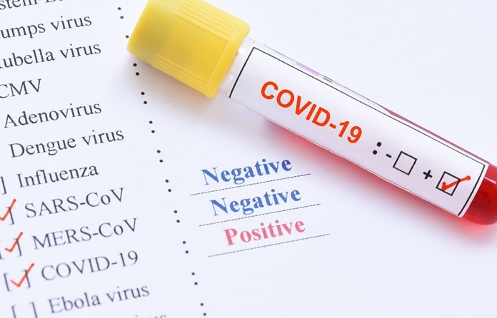 Προκλήσεις και προβλήματα από ψευδώς αρνητικά αποτελέσματα σε ασθενείς με λοίμωξη από τον ιό SARS-CoV-2