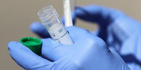 Οι μελέτες με τεστ αντισωμάτων μπορεί να υποεκτιμούν την πραγματική ανοσία απέναντι στον κορωνοϊό SARS-CoV-2