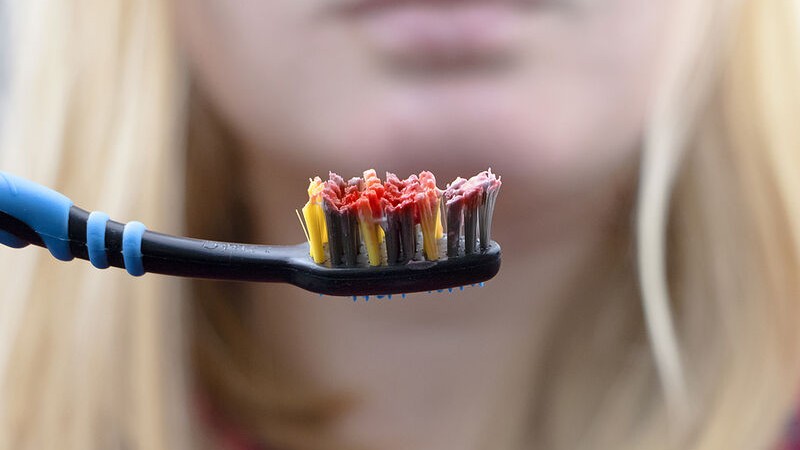 Η περιοδοντική νόσος είναι επιβαρυντικός παράγοντας για τη νόσο COVID-19