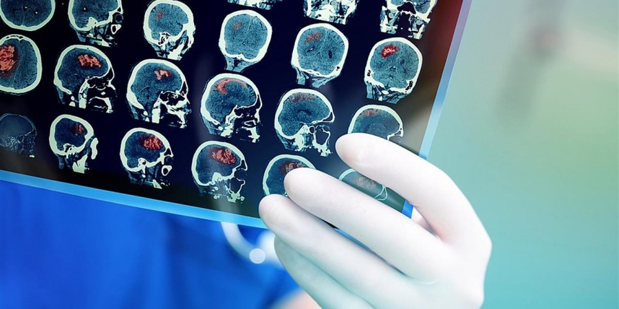 Η επίπτωση, τα κλινικά χαρακτηριστικά και η έκβαση ασθενών με εγκεφαλίτιδα σχετιζόμενη με τη νόσο COVID-19