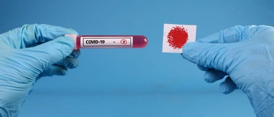 Ο καθημερινός έλεγχος για άτομα που ήρθαν σε επαφή με θετικό ασθενή και η μετάδοση σε σχολεία και πανεπιστήμια