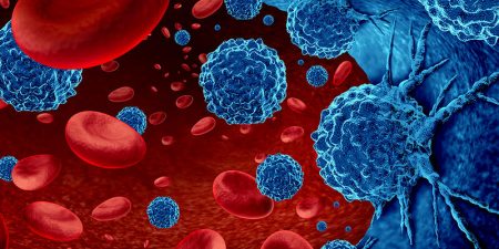 Μόλυνση από με τον ιό SARS-CoV-2 σε παιδιατρικούς ασθενείς με καρκίνο