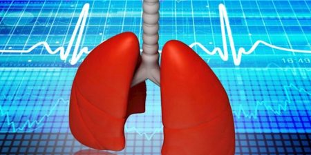 Η παρουσία μεταβολικού συνδρόμου αυξάνει την πιθανότητα για αναπνευστική ανεπάρκεια και θάνατο σε ασθενείς με COVID-19