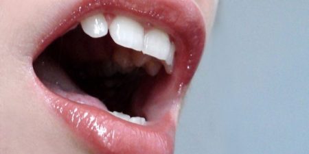 Νέα Δεδομένα στην Πρόληψη και Έγκαιρη Διάγνωση του Καρκίνου του Στόματος