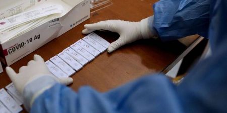 Διευκρινίσεις για την υποβολή στο ΠΣ ΕΡΓΑΝΗ της υπεύθυνης δήλωσης για τη διενέργεια rapid test