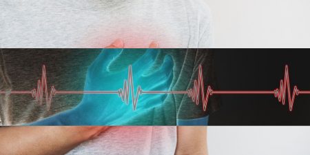 Η υπεργλυκαιμία αυξάνει τα καρδιαγγειακά συμβάντα σε ασθενείς που νοσηλεύονται με COVID-19