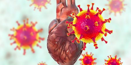 Καρδιαγγειακοί Παράγοντες Κινδύνου και Βαρύτητα Λοίμωξης COVID-19