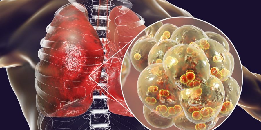 Επίπτωση της πανδημίας COVID19 στον προσυμπτωματικό έλεγχο για τον καρκίνο