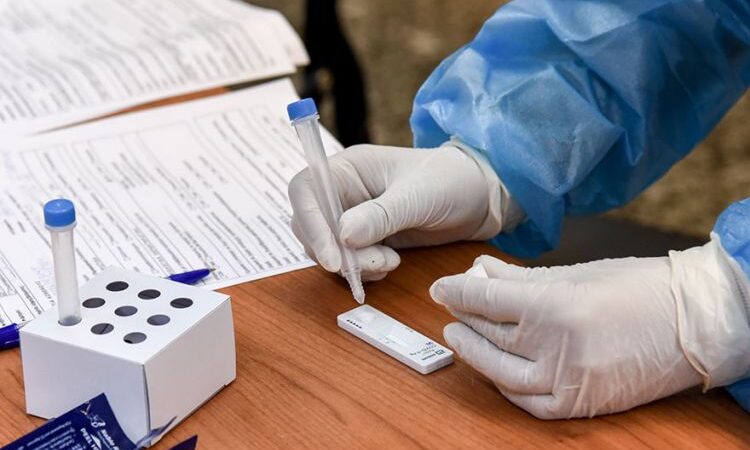 Τα 165 σημεία πού θα γίνουν δωρεάν rapid tests για Covid-19 σήμερα Δευτέρα