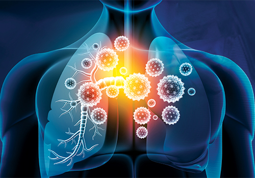 Η συχνότητα των λοιμώξεων αναπνευστικού από τον αναπνευστικό συγκυτιακό ιό RSV σε ενήλικες μεγαλύτερης ηλικίας