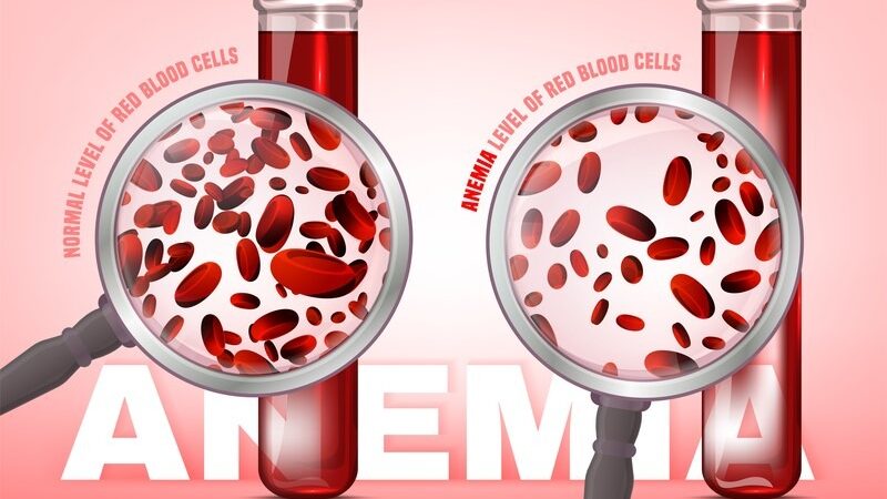 Ακόμη και η χαμηλή δόση ασπιρίνης αυξάνει τον κίνδυνο αναιμίας