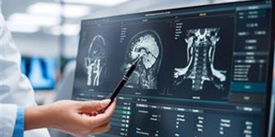 Η εγκεφαλική λειτουργικότητα μετά από COVID-19, πνευμονία, έμφραγμα του μυοκαρδίου ή σοβαρή ασθένεια