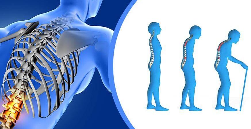Δήμος Αθηναίων: Δωρεάν εξετάσεις για την οστεοπόρωση στα Πολυδύναμα Δημοτικά Ιατρεία